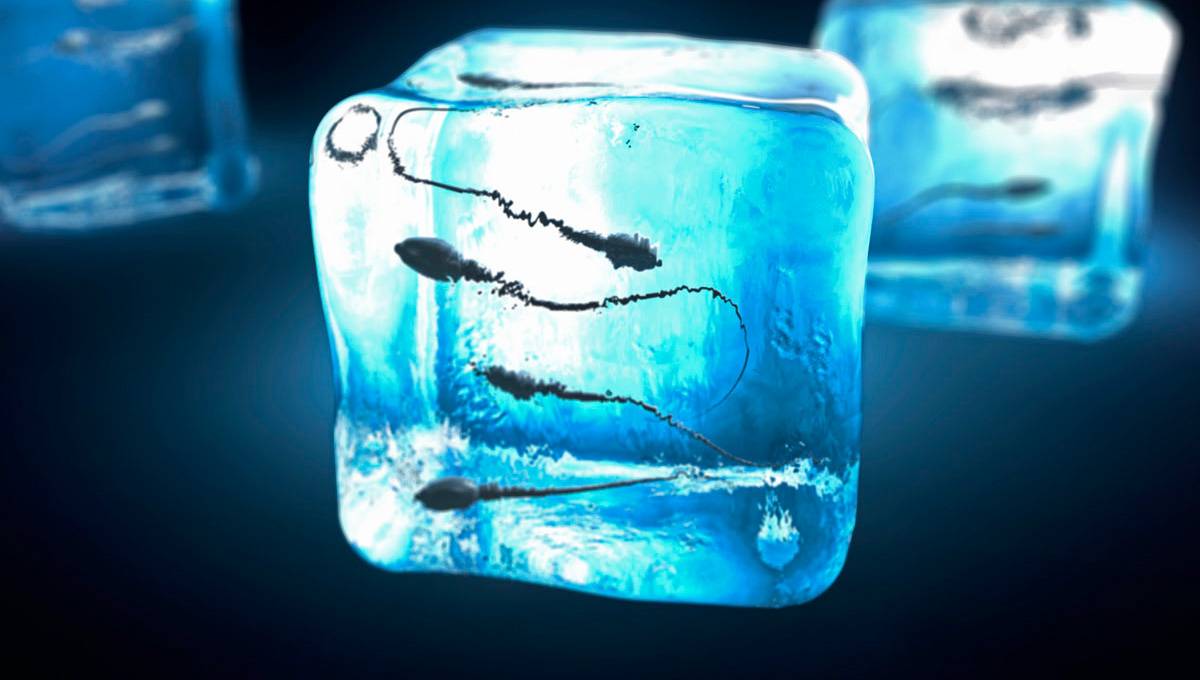Read more about the article Sperm freezing